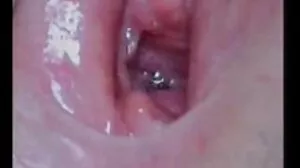 مسکراتے چلو سکاٹ ہو جاتا ہے ایک BW
